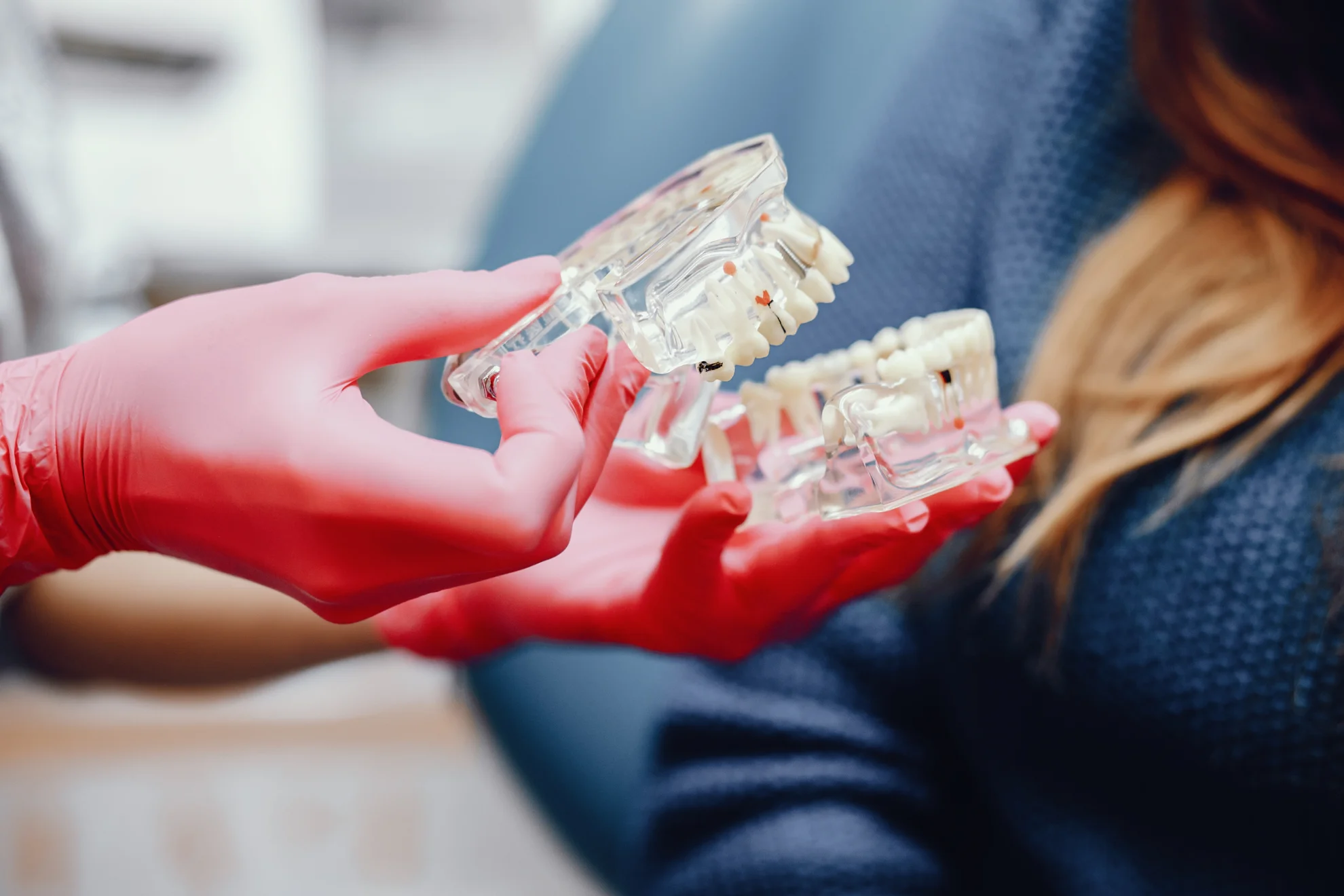 Implantes y prótesis en Valencia