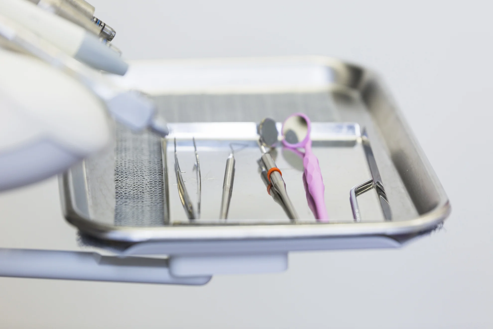 Endodoncia y extracciones en Valencia
