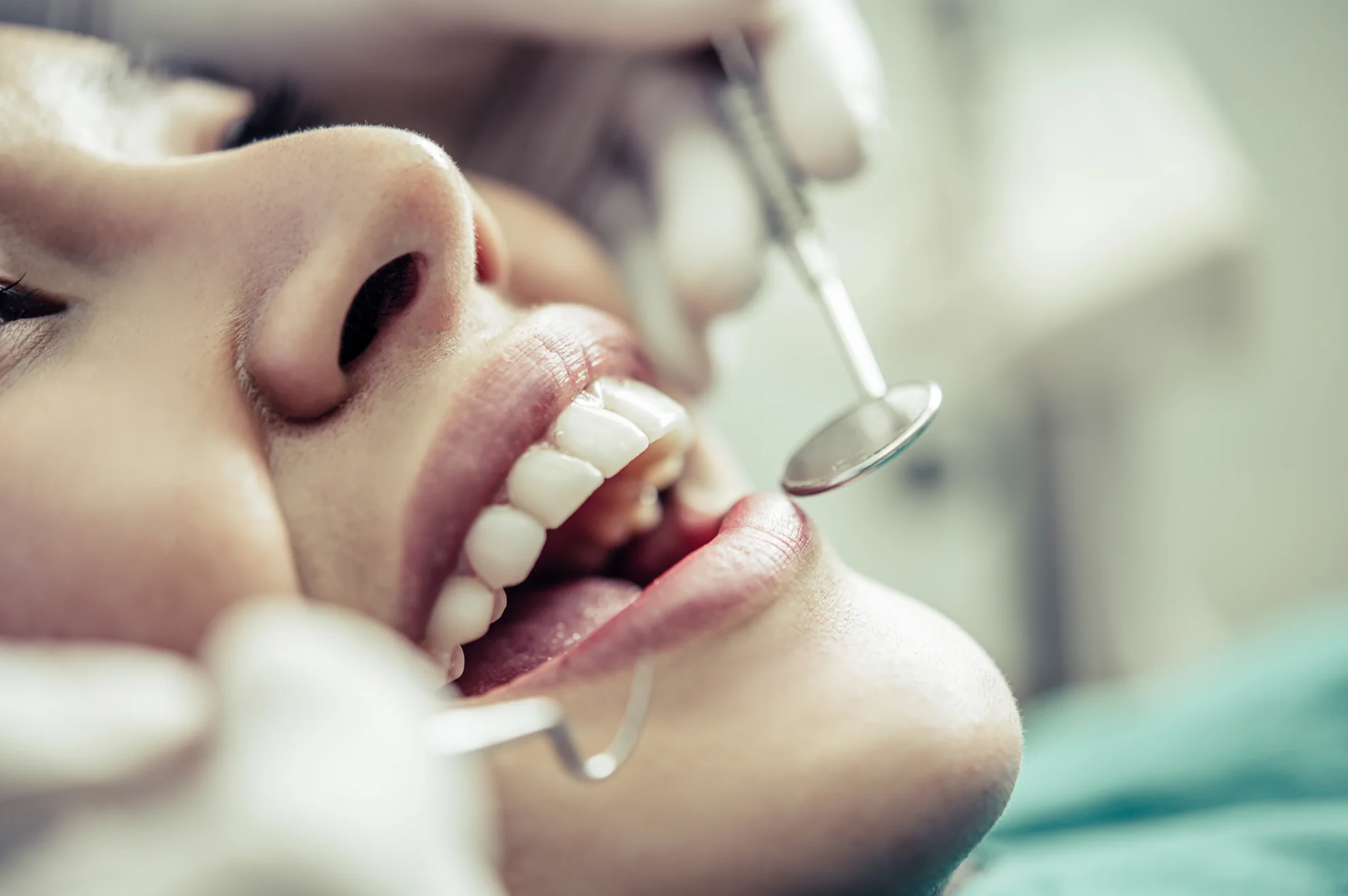 Estética dental en Valencia